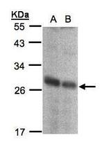 NQO2 Antibody in Western Blot (WB)