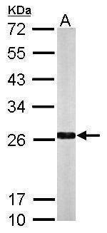 NQO2 Antibody in Western Blot (WB)