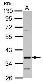 DMRT1 Polyclonal Antibody