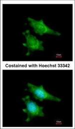 RIP2 Polyclonal Antibody