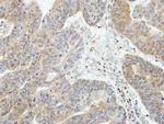 RIP2 Antibody in Immunohistochemistry (Paraffin) (IHC (P))
