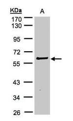 RIP2 Antibody in Western Blot (WB)