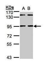 DCAF6 Polyclonal Antibody