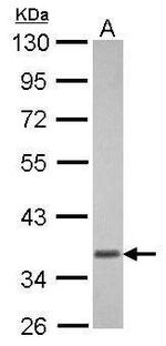 GNAT1 Antibody in Western Blot (WB)