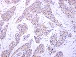 PIGK Polyclonal Antibody
