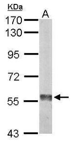 Monoamine Oxidase B Antibody in Western Blot (WB)