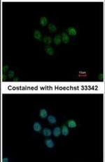 HDAC7 Antibody in Immunocytochemistry (ICC/IF)
