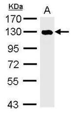 HDAC7 Antibody in Western Blot (WB)