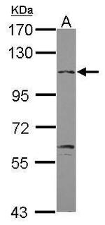 GABBR2 Antibody in Western Blot (WB)