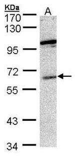 UBP1 Antibody in Western Blot (WB)