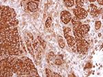 CaMKIV Polyclonal Antibody