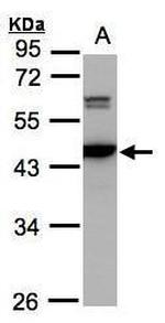 CaMKIV Antibody in Western Blot (WB)