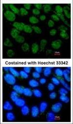 NR5A2 Polyclonal Antibody