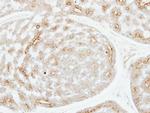 ADPGK Polyclonal Antibody