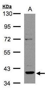 RAD51B Polyclonal Antibody