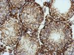 KCNG4 Antibody in Immunohistochemistry (Paraffin) (IHC (P))