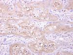 Adenylate Kinase 1 Polyclonal Antibody