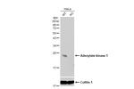 Adenylate Kinase 1 Antibody in Western Blot (WB)