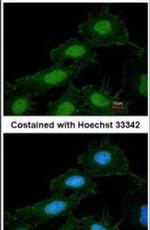 CaMKI Antibody in Immunocytochemistry (ICC/IF)