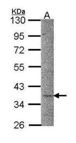 CaMKI Antibody in Western Blot (WB)
