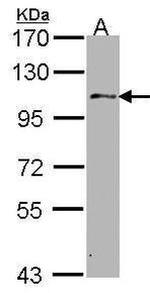 USP10 Antibody in Western Blot (WB)