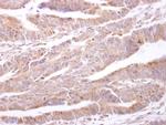 PTP1B Polyclonal Antibody