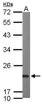 Sorcin Polyclonal Antibody