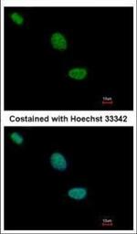 TLE2 Polyclonal Antibody