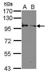 KELL Polyclonal Antibody