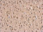 HSP70 Antibody in Immunohistochemistry (Paraffin) (IHC (P))
