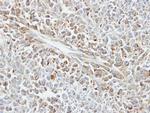 HSP70 Antibody in Immunohistochemistry (Paraffin) (IHC (P))