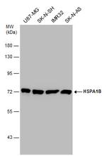 HSP70 Antibody in Western Blot (WB)