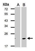 DPT Polyclonal Antibody