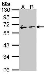 Arylsulfatase A Polyclonal Antibody
