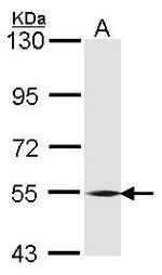 BMP-6 Polyclonal Antibody