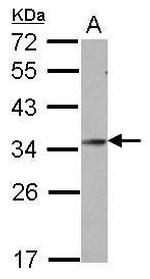 GSC Polyclonal Antibody