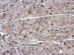 hnRNP A1 Antibody in Immunohistochemistry (Paraffin) (IHC (P))