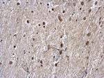 hnRNP A1 Antibody in Immunohistochemistry (Paraffin) (IHC (P))