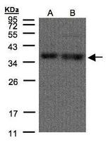 hnRNP A1 Antibody in Western Blot (WB)