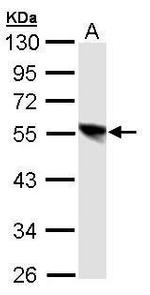 DP1 Polyclonal Antibody