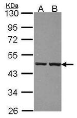 ZNF396 Polyclonal Antibody