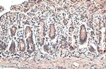 ESRRA Polyclonal Antibody