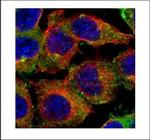 CD2AP Polyclonal Antibody