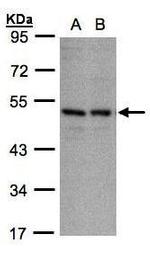 KIR3DL1 Polyclonal Antibody
