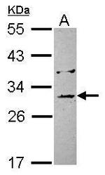 EB1 Antibody in Western Blot (WB)