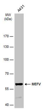 MEFV Antibody in Western Blot (WB)