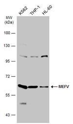 MEFV Antibody in Western Blot (WB)