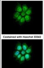 MEFV Antibody in Immunocytochemistry (ICC/IF)
