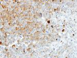 HIP55 Antibody in Immunohistochemistry (Paraffin) (IHC (P))