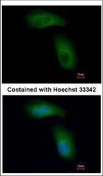 TRIM36 Polyclonal Antibody